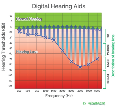 Modern digital hearing aids separately amplify up to 64 frequency bands , to restore the wearers hearing to normal hearing levels.