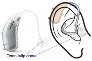 open-fit-hearing-aids-expert-hearing